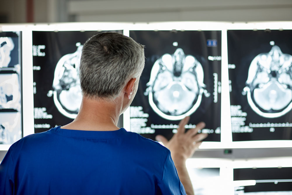 abogado de lesiones cerebrales traumáticas del condado de orange