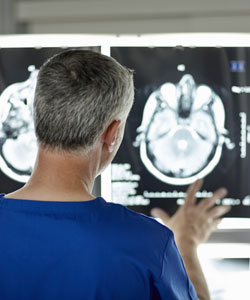 abogado de lesiones cerebrales traumáticas del condado de orange